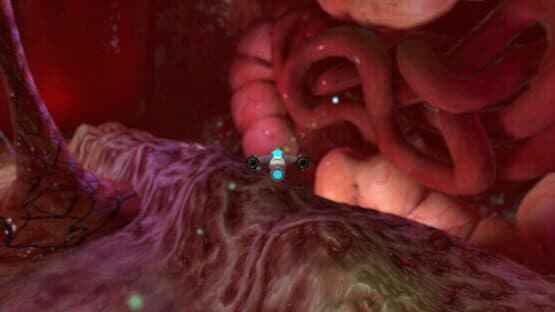 Placebo Effect — screenshot 7