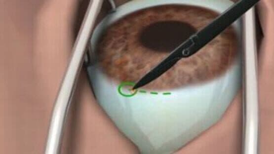 Surgery Simulator — screenshot 1