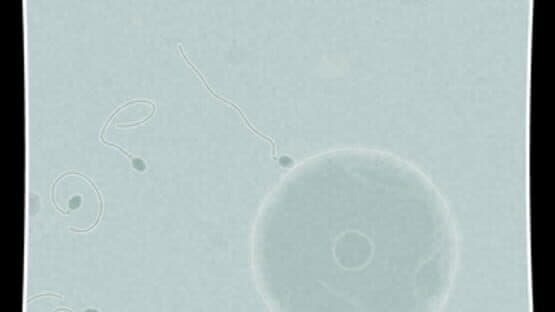 Coil — screenshot 4