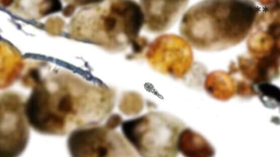 Microscopic — screenshot 8