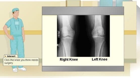 Virtual Knee Surgery — screenshot 1