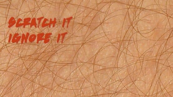 Itch — screenshot 1